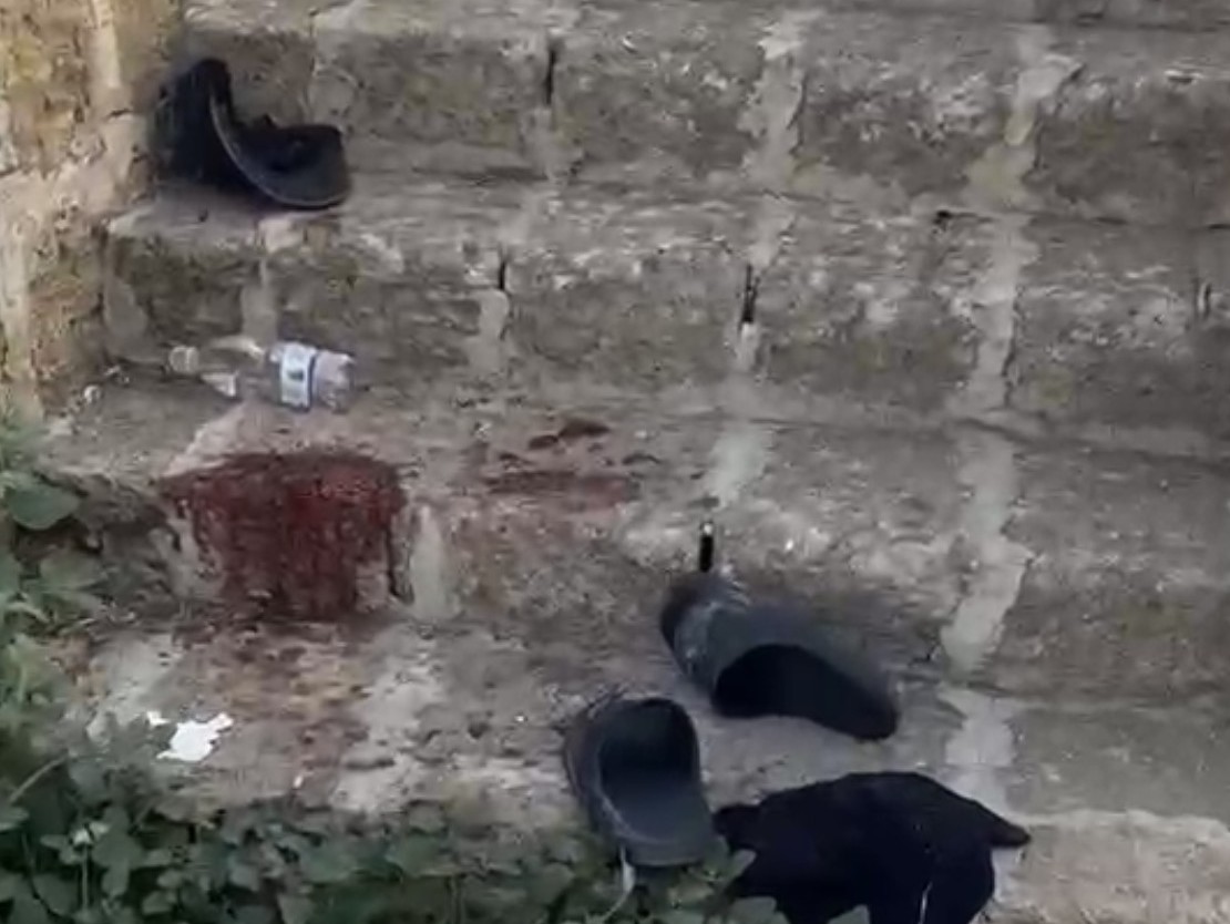 Immagine articolo: Marinella, ancora una rissa nella notte tra stranieri. Due persone con ferite gravi in Ospedale