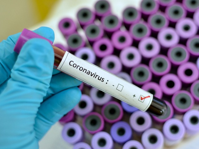 Immagine articolo: Aggiornamento Coronavirus in Provincia di Trapani. 53 i casi positivi